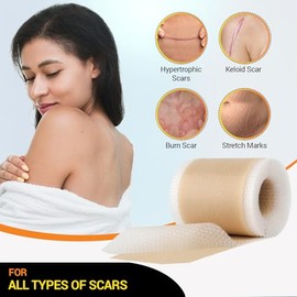 M PAIN MANAGEMENT TECHNOLOGIES Cinta De Silicona De Grado Médico Para Cicatrices(Rollo De 152 Cm X 3,8 Cm) | Tiras De Silicona Reutilizables Para Cesáreas, Cirugías, Quemaduras, Queloides, Acné Y Más