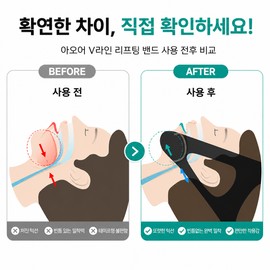 아오어 에어핏 입벌림방지 수면밴드 코골이 방지 턱밴드 Aoer Air Fit Mouth-Opening Prevention Sleep Band Snoring Prevention Chin Strap