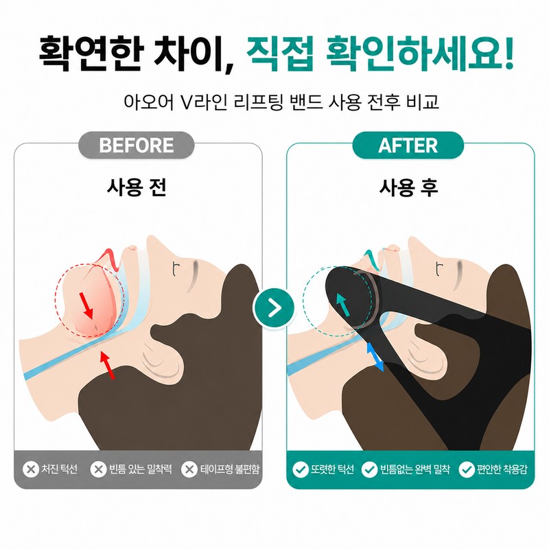 아오어 에어핏 입벌림방지 수면밴드 코골이 방지 턱밴드 Aoer Air Fit