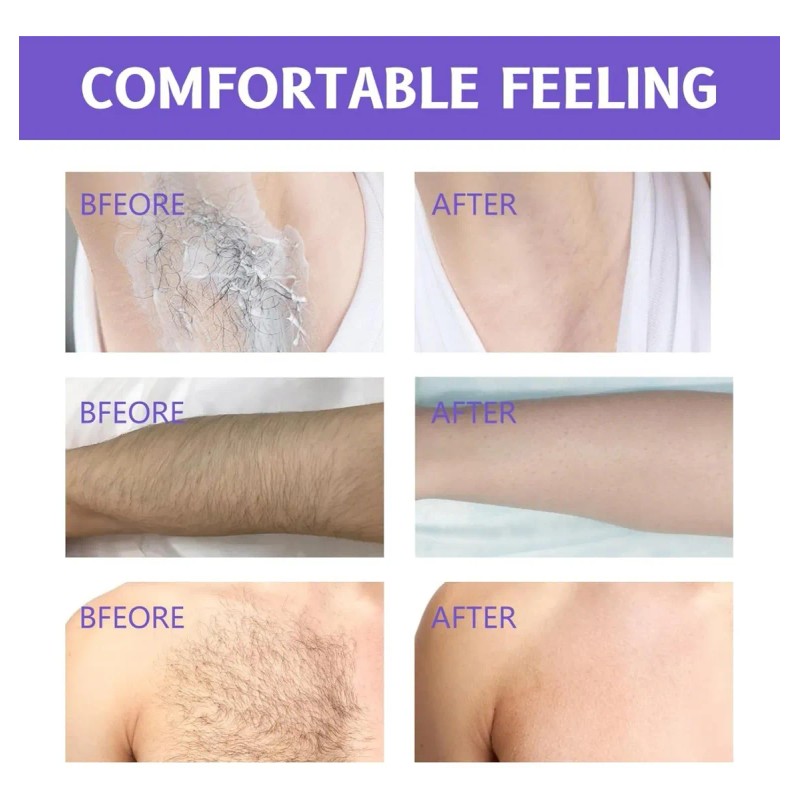 Crema De Depilación Corporal Para Pieles Sensibles, 1 Unidad