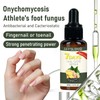 Fix Gray Nails Fast! Jaysuing Ginger Nail Repair Solution –