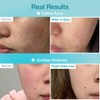 Numbuzin [Numbuzin]No.1 Pantothenic B5 Hyaluronic Active Clear Mask (5ea)