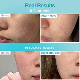 Numbuzin [Numbuzin]No.1 Pantothenic B5 Hyaluronic Active Clear Mask (5ea)