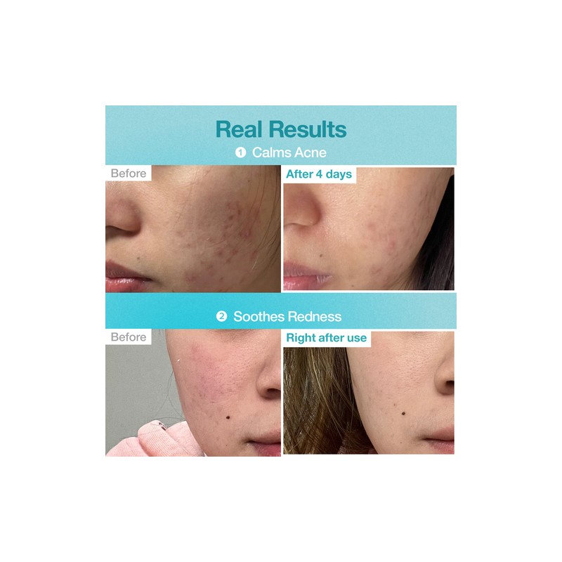 Numbuzin [Numbuzin]No.1 Pantothenic B5 Hyaluronic Active Clear Mask (5ea)