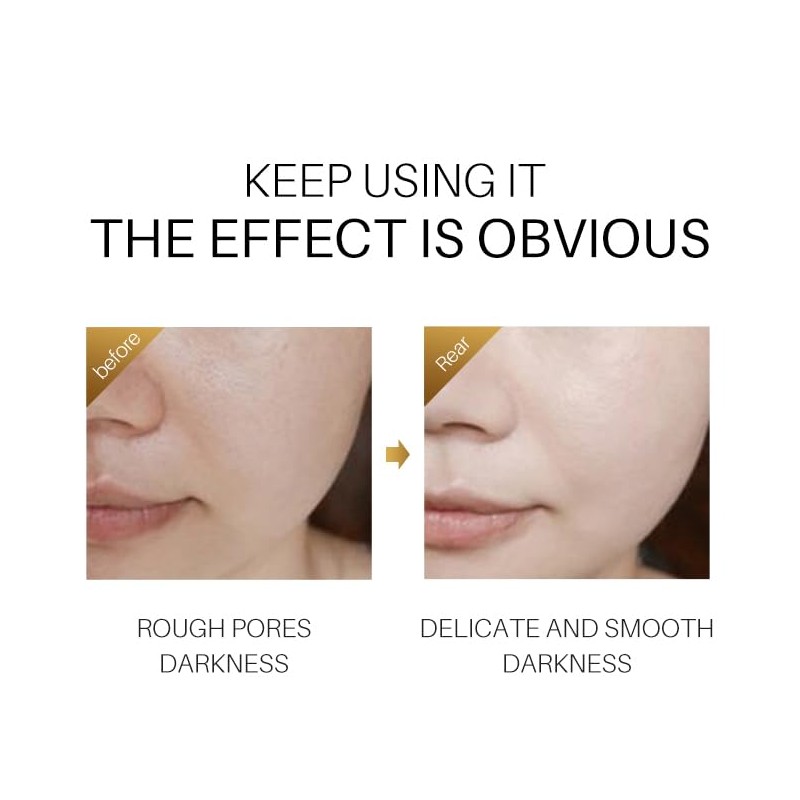 THE ISMA Vitamin C Serum for Face, Anti-Aging, 20% Vitamin