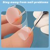 101 Pcs Ingrown Toenail Treatment Set, Clear Ingrown Toenail Corrector