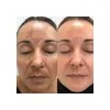 Crema Facial Manchas/arrugas Baba De Caracol Shelo Nabel