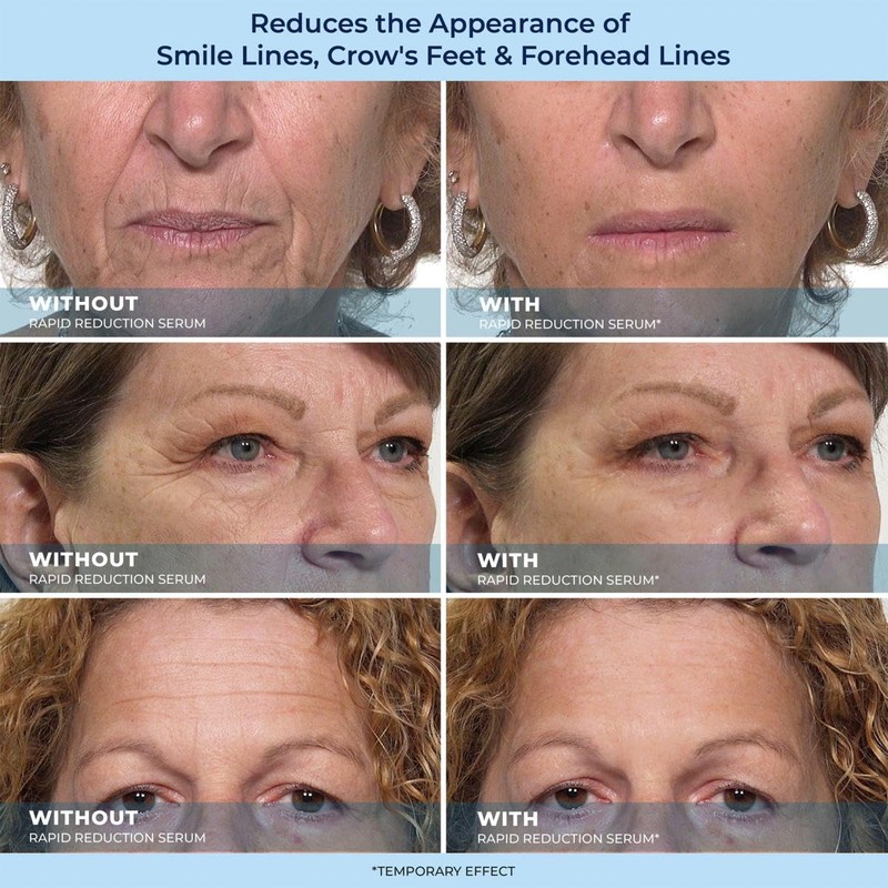 Plexa derm Rapid Reduction Wrinkle Serum - Reduces Under-Eye Bags,
