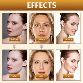 7-Day Quick Skin R-epair Cream, Skin R-epair C-ream, 7-Day Multi-Effect All-in-One Skin Care Cream, Intensive skins care and wrinkle reduction, Skin Care C-ream for All S-kin Types (2pcs)