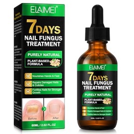 Ginger Nail Treatment, Natural Plant Formula Nail Growth Serum, Ginger Cuticle Care Oil for Strengthen & Promote Nail Growth & Repair Nutrient Oil (1PC)