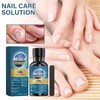 Advanced Nail Formula for Toenail and Fingernail - Nourishing and