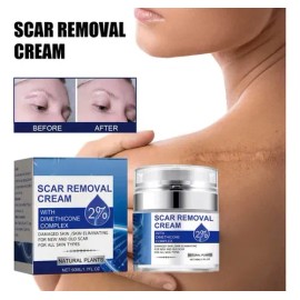 Cremas Para Cicatrices Profundas