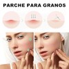 Parches para Acné, 316 Parche Maestro para el Acné, Parches