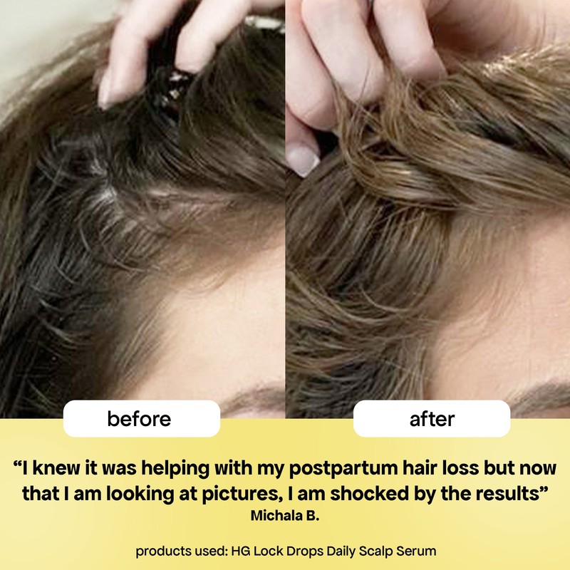 Bondi Boost Lock Drops Anti-Shedding Scalp & Hair Serum 30ml