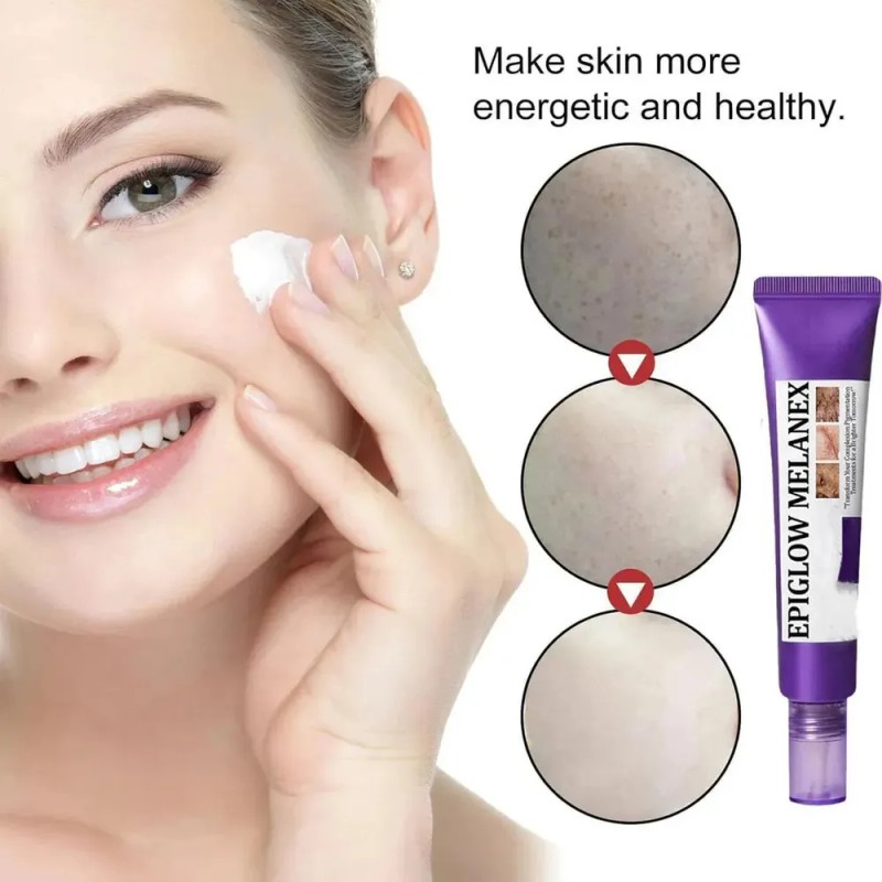 Iu Crema Epiglow Melanex Antihiperpigmentante Avanzada,