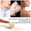 4.9ft 1.6in Scar Roll Silicone Scar Sheets Professional Scar Removal