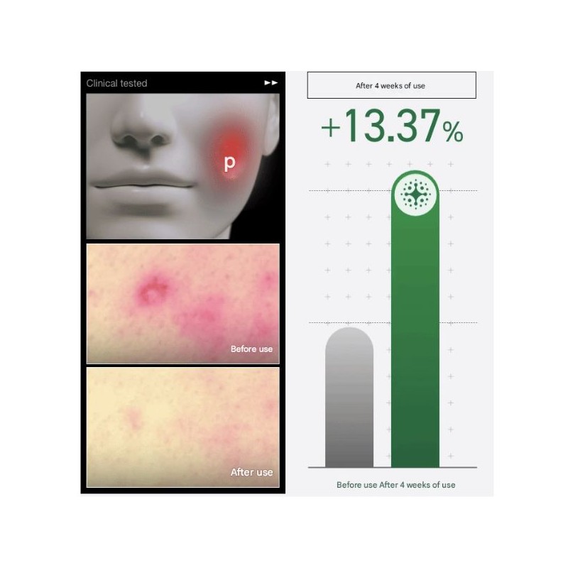 Anua Heartleaf Centella Red Spot Cream 30g