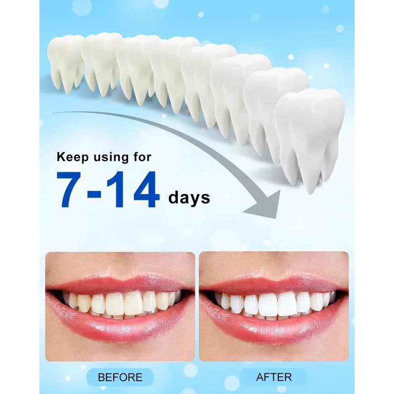 MySmile 2Pack Pro Teeth Whitening Kit with 28-LED Light Tray