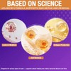gel de silicona para cicatrices de silicona