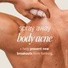 First Aid Beauty Body Acne Spray - Maximum Strength Body