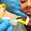 Dental X-Ray Positioning Indicator Aligning Arm - Intraoral Film Positioner