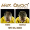 Hair Quicky® Premium Hair Fibres, Pouring Hair, Scattered Hair, Instant