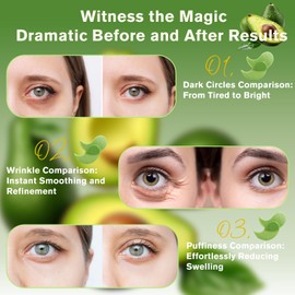 Lktvys Nourishing Avocado Eye Patches Eye Mask – 120PCS (2-Pack), Nourishing Under Eye Pads with Plant-Based Formula, Gentle Skincare for Dark Circles, Puffiness & Fine Lines