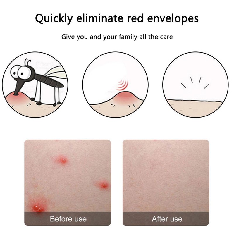 Mosquito Bite Antipruritic Instrument Adjustable Anti Mosquito Antipruritic Pen