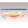 Mizuku Medical Plus Moist V (Non-Sterile Type) VA1A (7.9 x