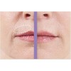 CREMA ANTIARRUGAS LABIO SUPERIOR TRIPLE SUAVE ELIMINA ARRUGAS EN LOS