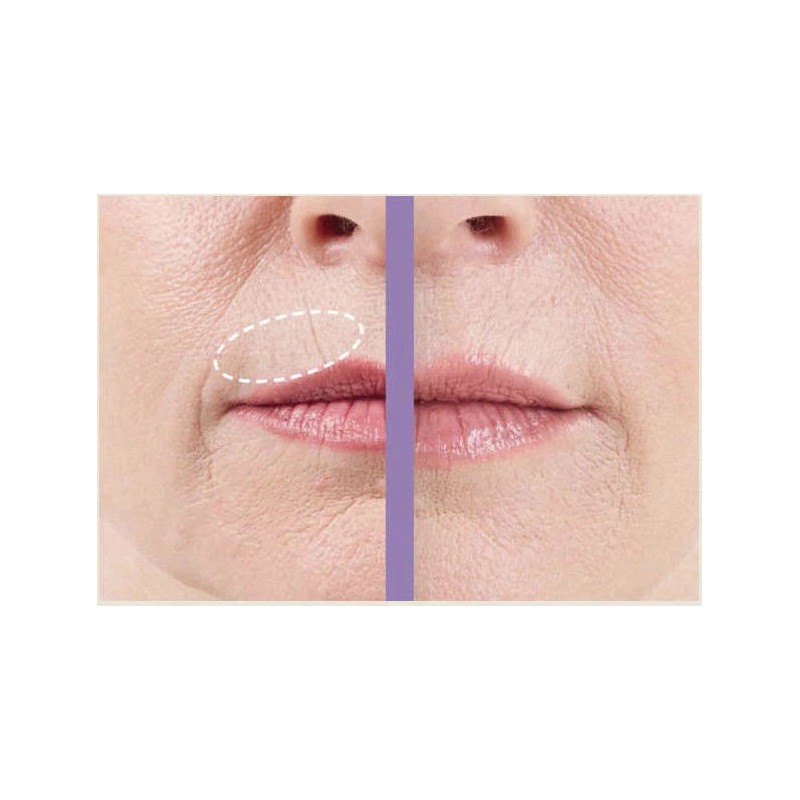 CREMA ANTIARRUGAS LABIO SUPERIOR TRIPLE SUAVE ELIMINA ARRUGAS EN LOS
