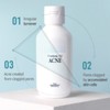 Pyunkang Yul [Pyunkang Yul]ACNE Toner 150ml Pouch Set