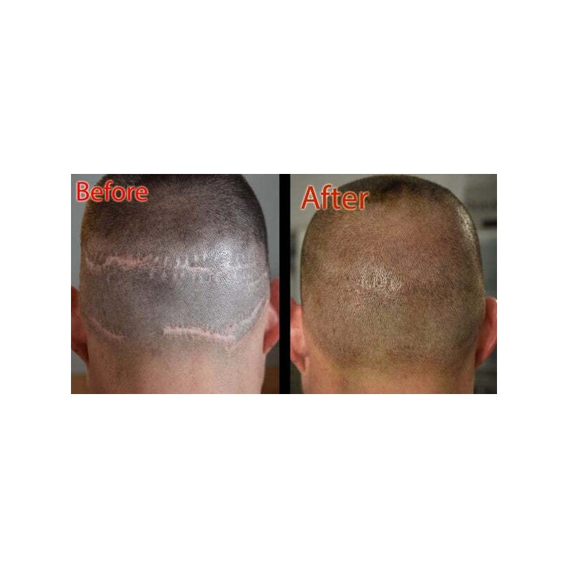 3-Pack - All SMP Scalp pigments - Half Oz