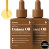 Keyoma Batana Oil for Hair Growth with Rosemary: Nourish &