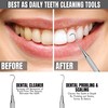 Professional Dental Tools |Tartar Scraper for Dentist, Personal Use and