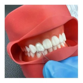 Hassta Plantillas Moldes  Para Carillas De Venner Y8nm Scii