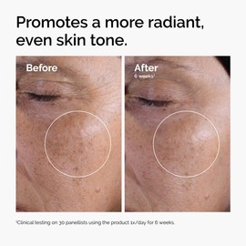 The Ordinary The Ordinary Glycolic Acid 7% Exfoliating Toner, Brightening and Smoothing Daily Toner for More Even-Looking Skin Tone, 3.4 Fl Oz