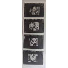 Prank 3D Customized Fake Ultrasound Strip of 4 Photos