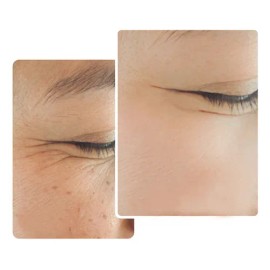 TonyMoly Gimiya Crema Facial Premium Antimanchas y Paño Todo Tipo de Piel