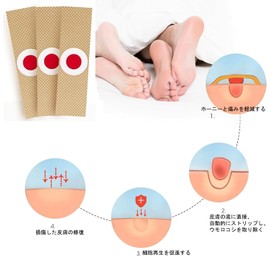 Mcvcoyh 20 Count Protective Pads for Toe Quints, Circle Type