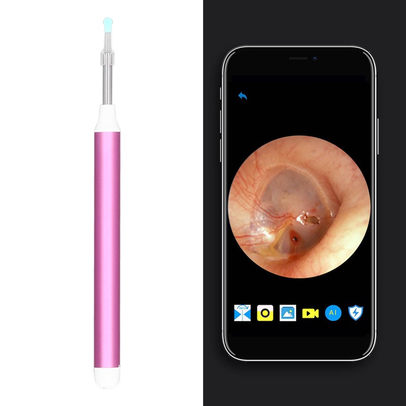 Ear Wax Removal Tool Camera Cleaner Earwax Remover Kit Wireless