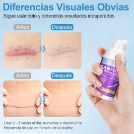 Crema Eliminadora De Cicatrices Y Marcas En Piel - Intensivo nocturno 30 ml 
