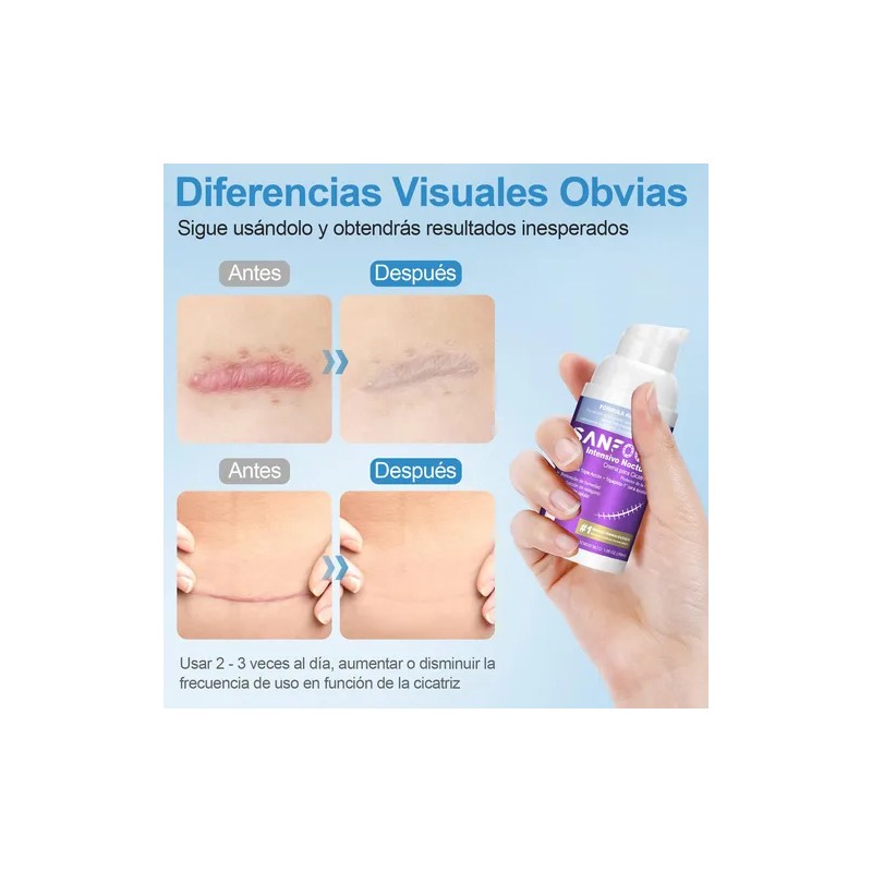 Crema Eliminadora De Cicatrices Y Marcas En Piel - Intensivo