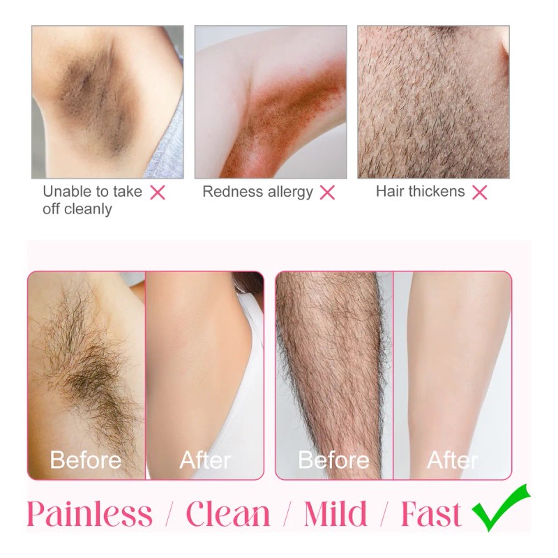 Crema Depilar Mujer Indolora Fórmula Sensible Areas Intimas