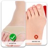 Metatarsal Pad S (EU 35-40), Comfortable Metatarsal Pad with Soft,
