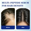 GHK-Cu Peptide Hair Growth Serum, 10% Copper Peptides Scalp Serum