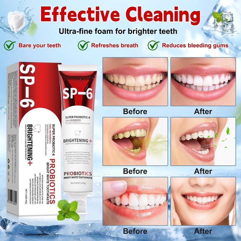 Sp-6 Probiotic Brightening Toothpaste, 2PCS 140g Super Probiotic SP-6 Whitening