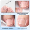 20 Piezas Kit Para Uñas Enterradas, Professional Ingrown Toenail Set,