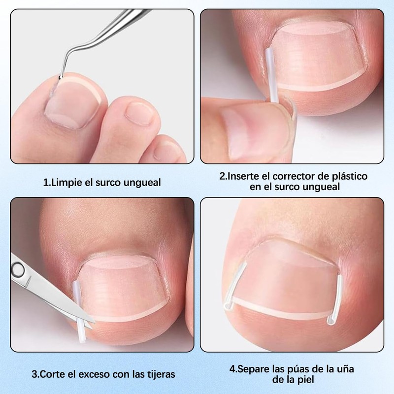 20 Piezas Kit Para Uñas Enterradas, Professional Ingrown Toenail Set,