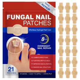 Pack of 21 Mushroom Nail Treatment Patches, Mushroom Nail Patches, Toenail Correction Patch, Multi-Purpose Toenail Repair Pads for Damaged Nails and the Appearance of Discoloured Nails